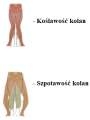 Orteza na Szpotawość i Koślawość Stabilizator Stawu Kolanowego [Rozmiar: S, Wariant: B]